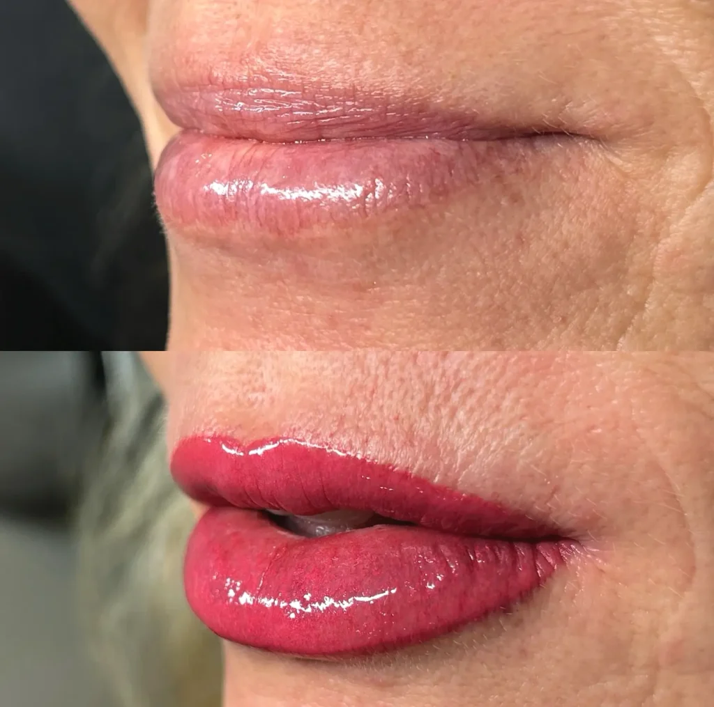 Skin Type & Placement Impact