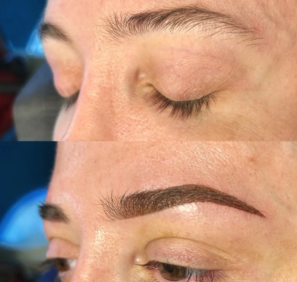 What Can Thicken Lines After Tattooing